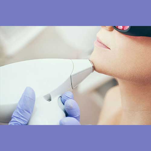 Laser Smooth Company_Laser Hair Removal Questions