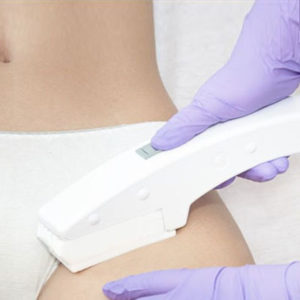 Laser Smooth Company_Laser_hair_removal_health_01