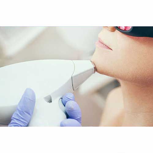 Laser Smooth Company_Laser Hair Removal Questions_01