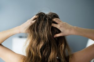 get rid of dandruff keravive scalp treatment